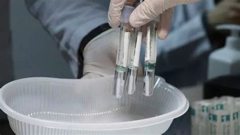 İ­s­v­e­ç­­t­e­ ­1­0­0­ ­b­i­n­ ­k­i­ş­i­y­e­ ­s­a­h­t­e­ ­P­C­R­ ­t­e­s­t­i­ ­s­a­t­ı­l­d­ı­